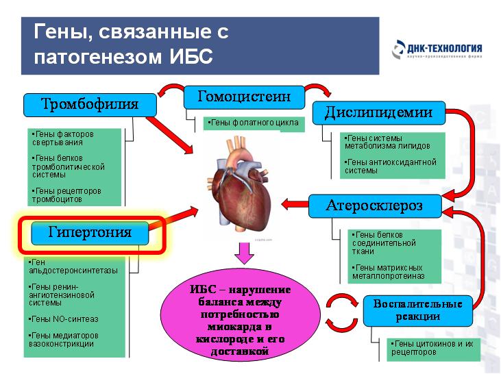 Ишемическое сосудистое заболевание