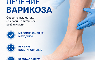 К вечеру ноги гудят, появляются отеки, а сосудистые «звездочки» становятся все заметнее?